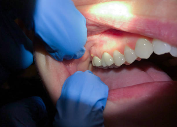 Best Emergency Dental Care for Broken or Chipped Teeth in Bay, AR